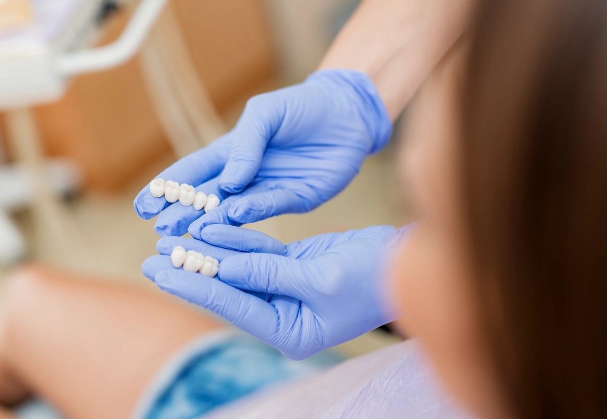 A dentist with blue gloves holds two dental mold trays with tooth replicas, explaining the porcelain veneers cost with insurance to a patient. The patient, with brown hair, is sitting in a dental chair, attentively observing the molds.