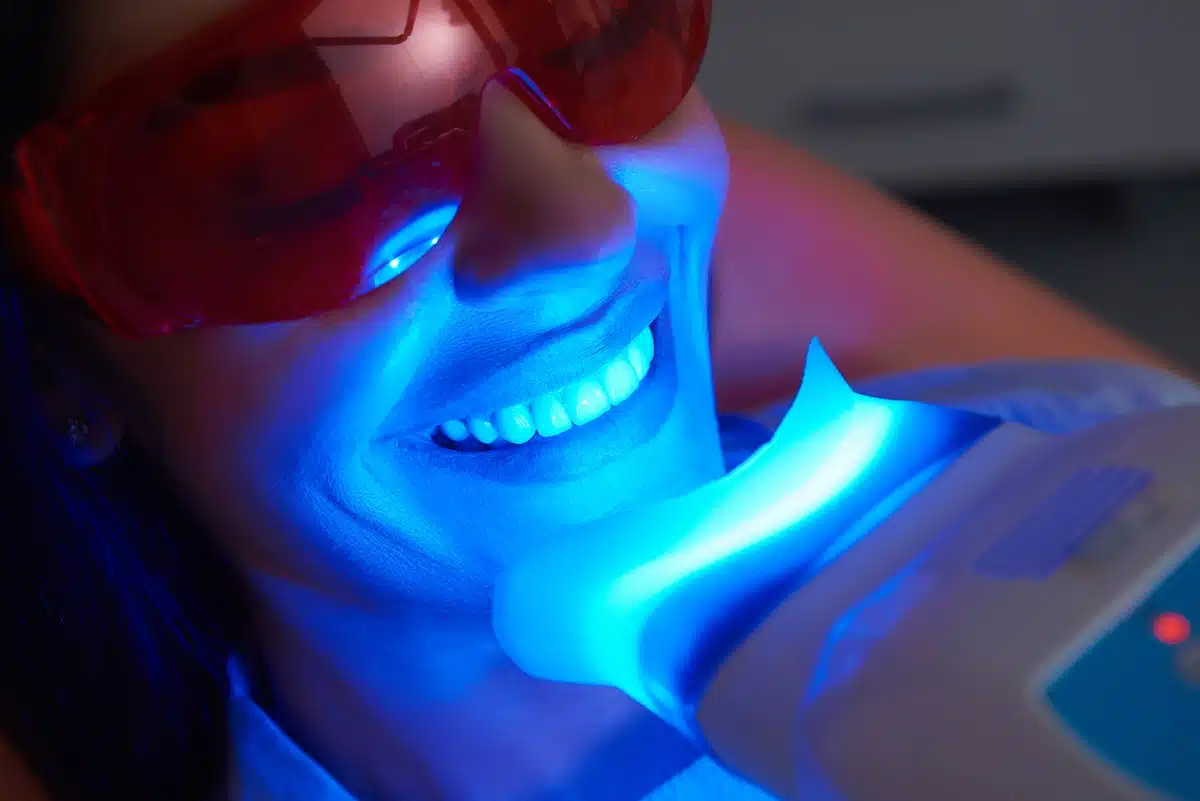 close up to woman having teeth whitening procedure 