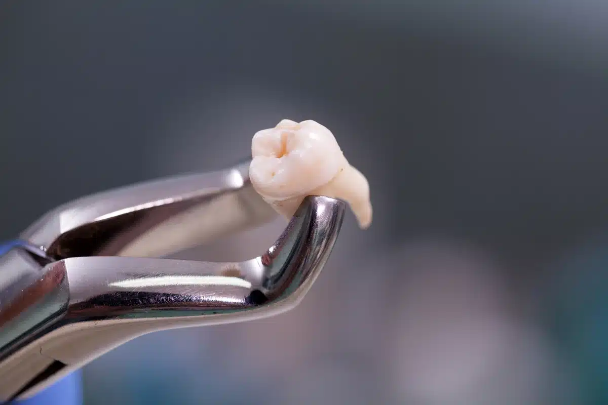 tooth and pliers