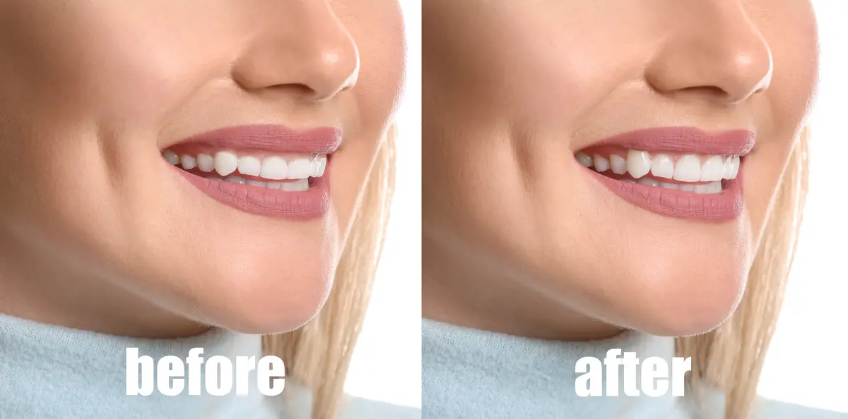 before and after blonde woman