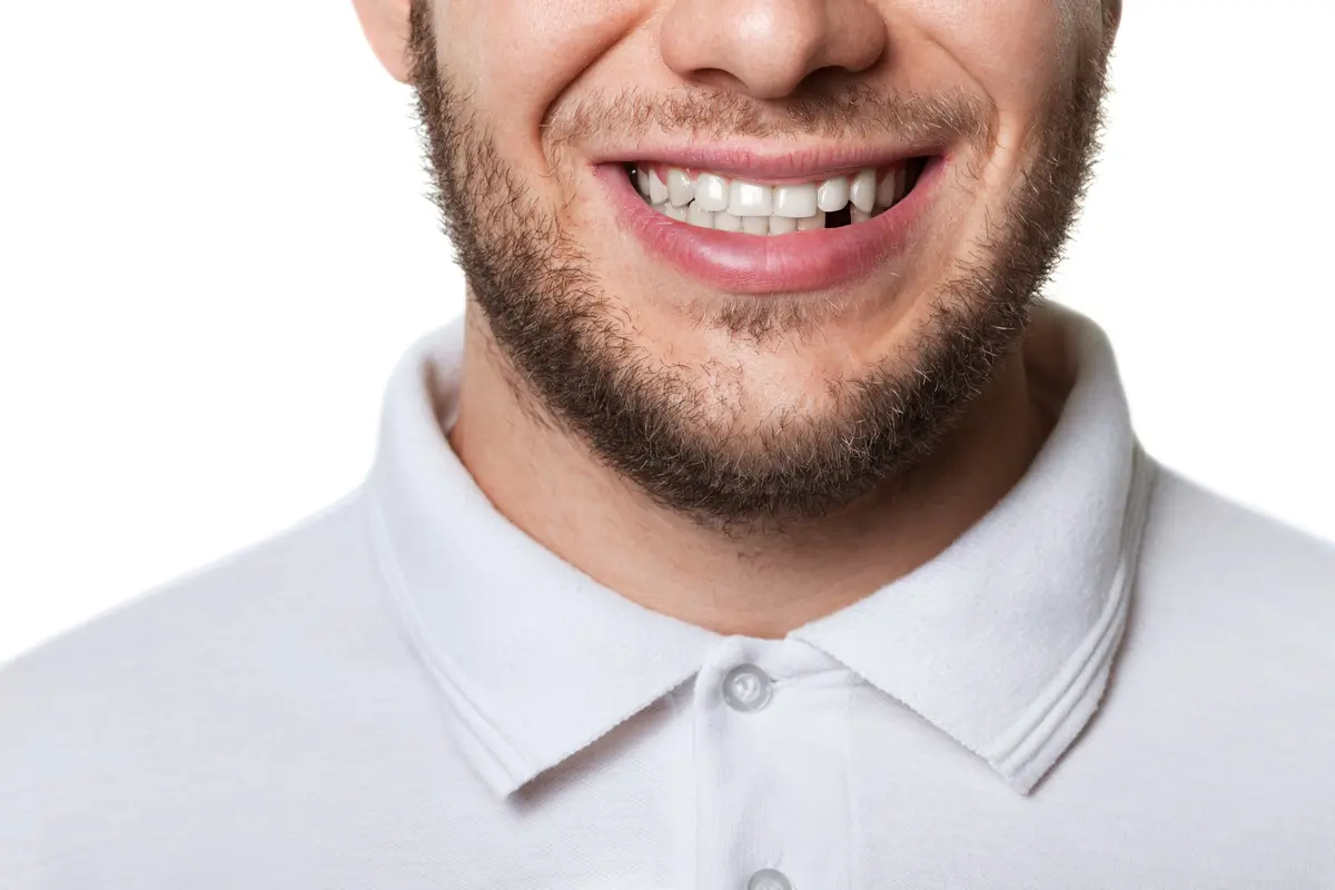man with lower tooth missing
