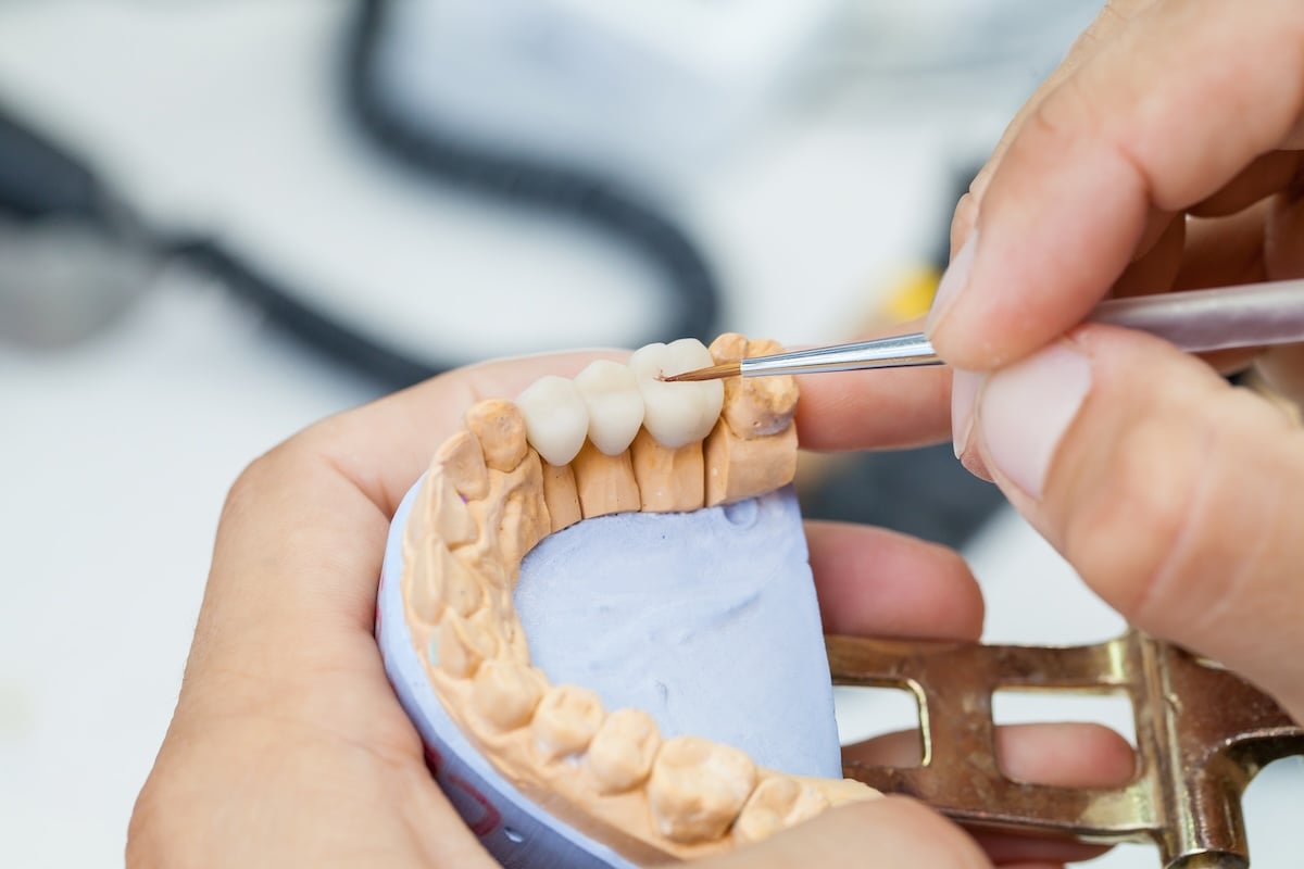 A close-up of hands working on a dental bridge