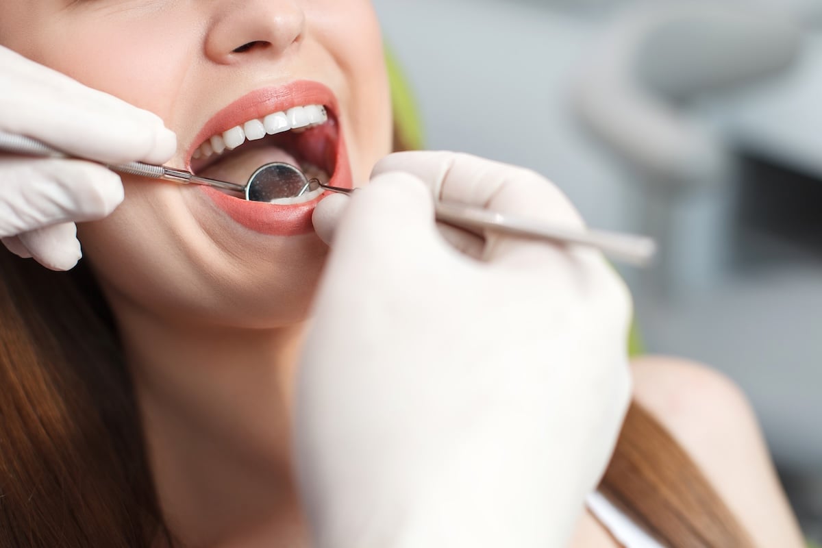 A close-up of a person at the dentist, with their mouth open