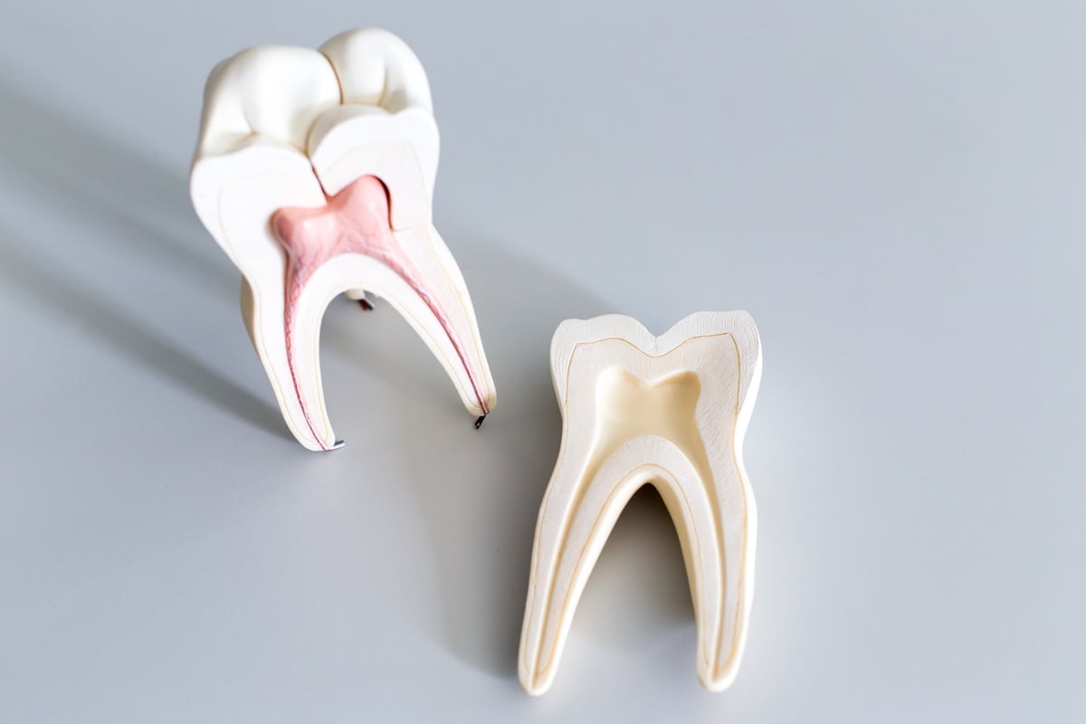 Two anatomical tooth models are shown on a white surface. The left model is sectioned to reveal inner tooth layers and pink pulp, helping illustrate procedures like root canals