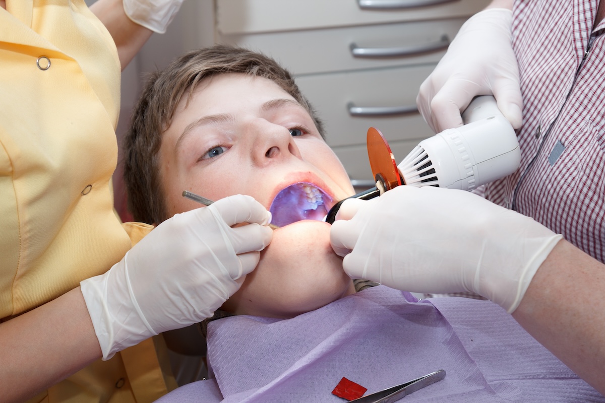 A young person at the dentist’s office receives a dental procedure. The dentist uses a curing light to apply dental sealant