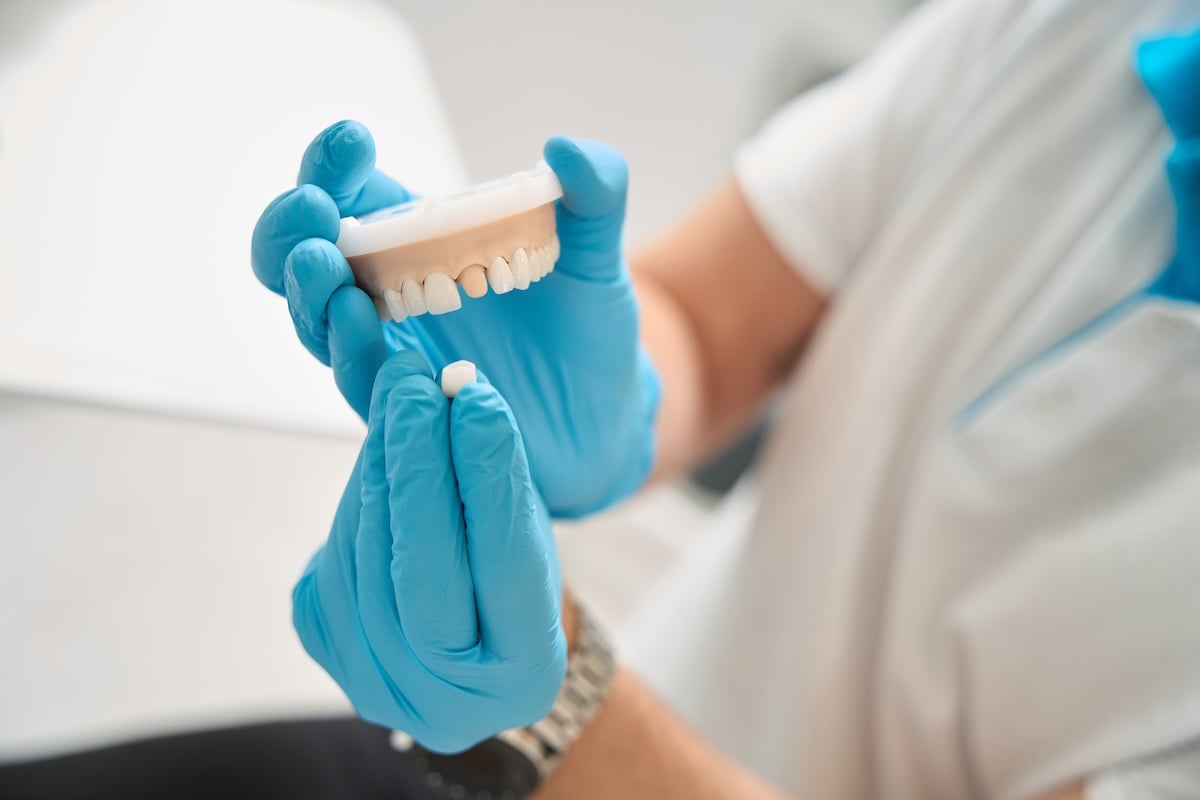 A person wearing blue gloves holds a dental model and a dental crown, demonstrating a tooth implant or restoration procedure.