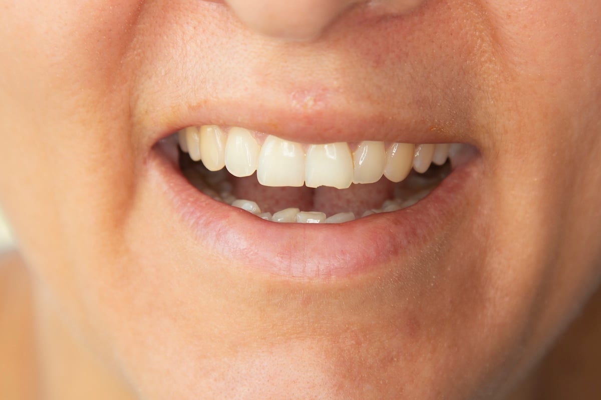 A close-up of a person's mouth, slightly open to show their upper and lower teeth. 