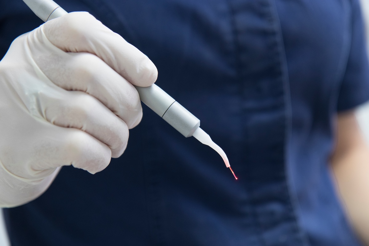 A person wearing white gloves and a navy shirt holds a dental laser tool with a glowing red tip, likely used for dental treatments or surgery.