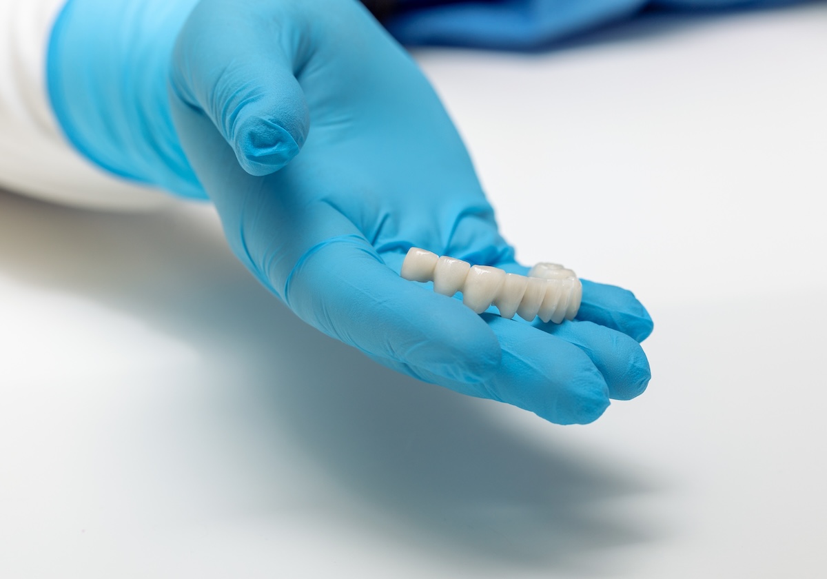 A hand wearing a blue medical glove holds a set of dental crowns or artificial teeth against a white background.