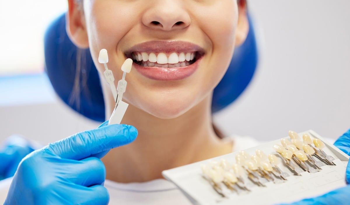 A person smiling while a dental professional holds up tooth shade guides near their mouth, comparing tooth colors for a possible dental procedure.