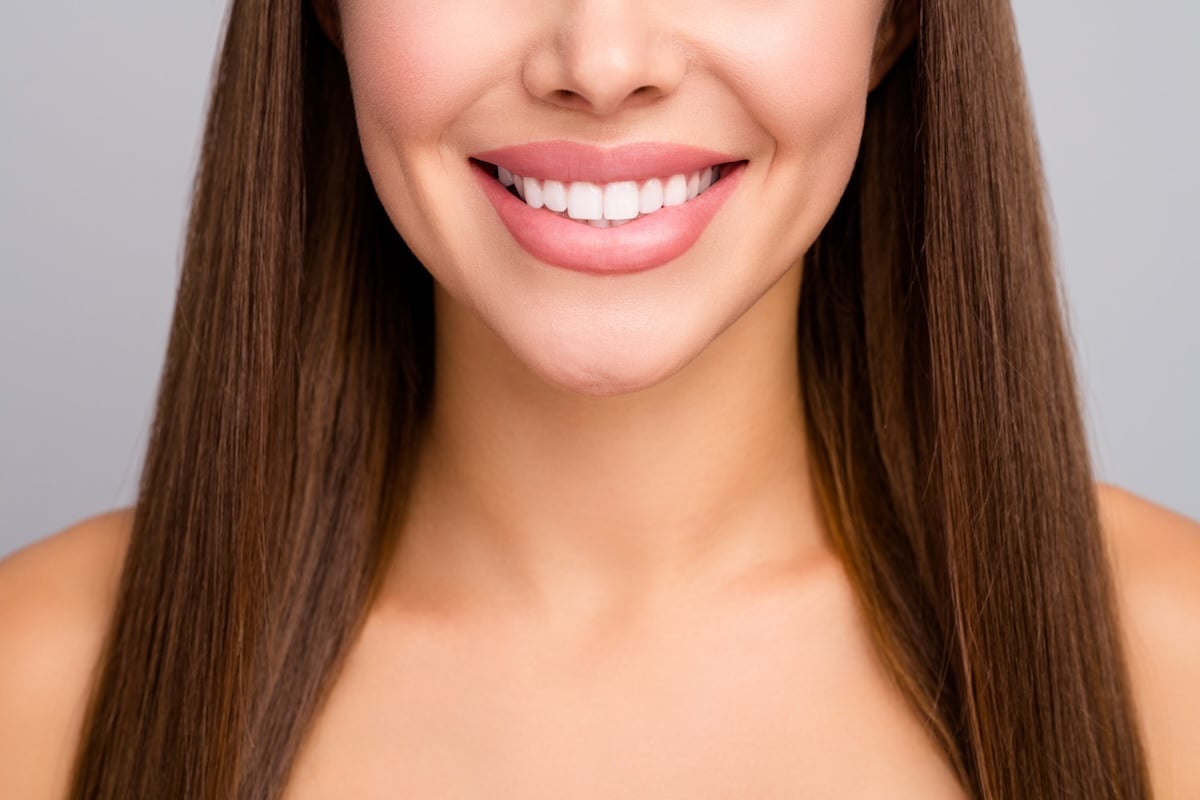 woman smiling with veneers