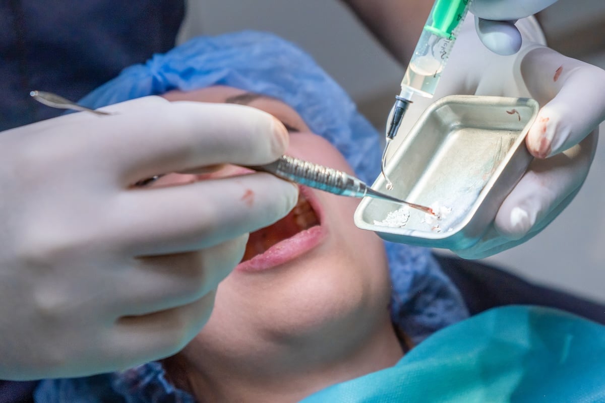 A dentist wearing gloves prepares dental material